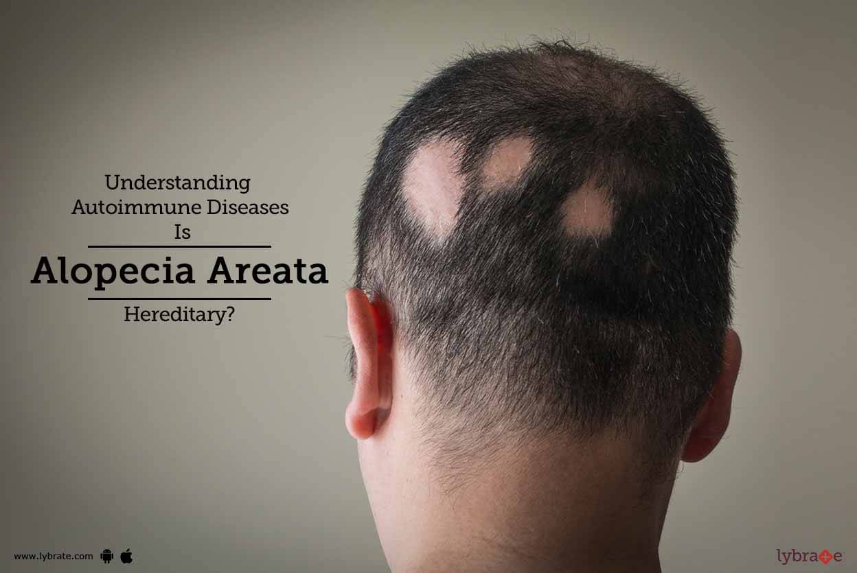 understanding-autoimmune-diseases-is-alopecia-areata-hereditary-by