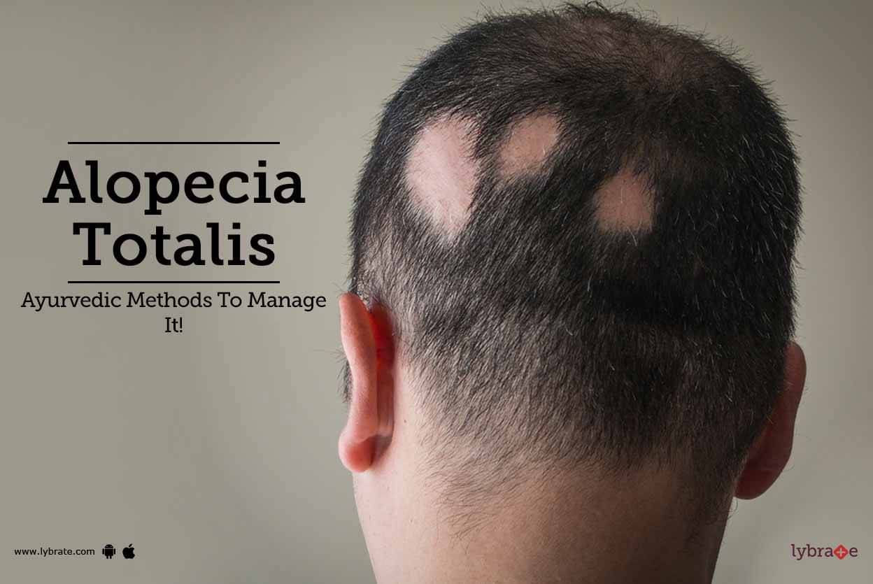 alopecia totalis universalis