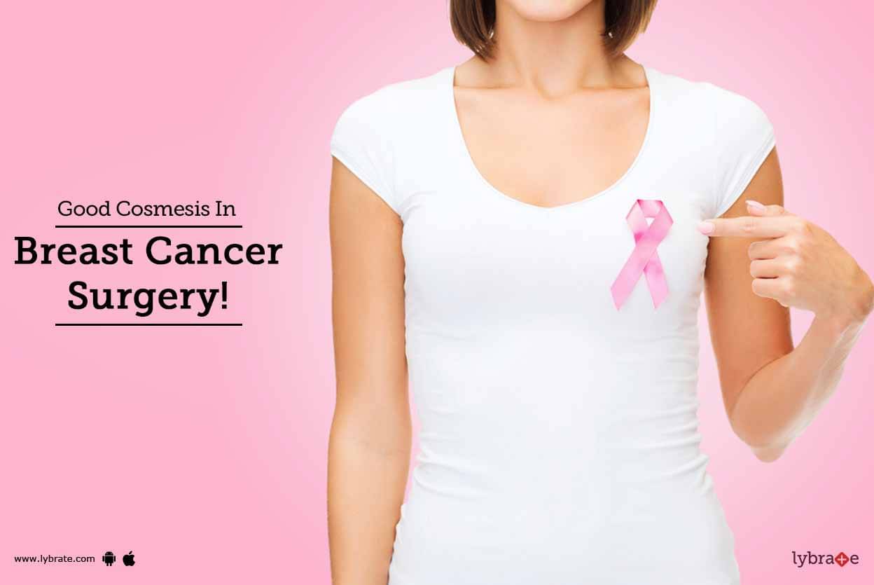 Good Cosmesis In Breast Cancer Surgery! - By Dr. Chaitanyanand B ...