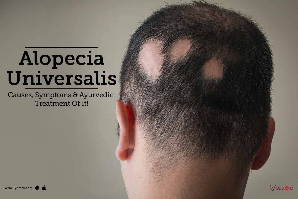 alopecia universalis regrowth signs