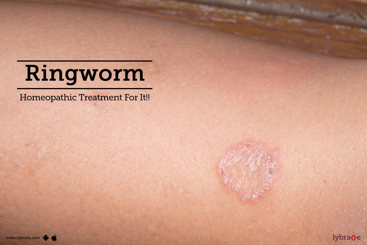 Breast yeast infection and homeopathy picture 953
