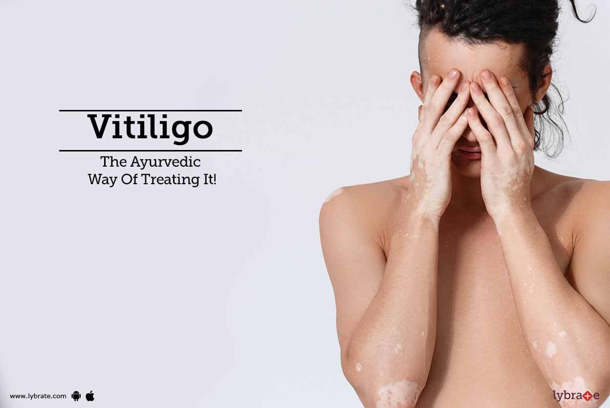 Vitiligo The Ayurvedic Way Of Treating It By Dr Nabanita Das Lybrate 8394