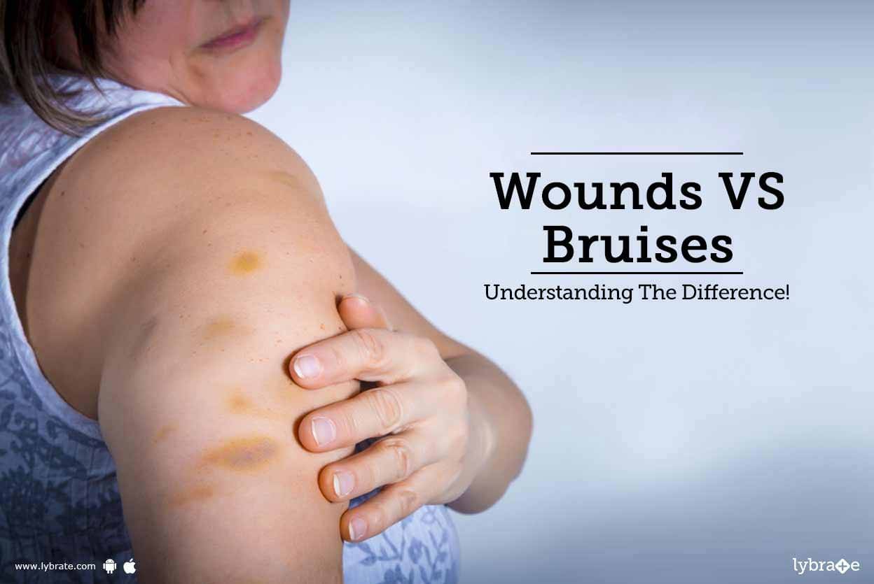 Wounds Vs Bruises - Understanding The Difference! - By Dr. Bikram 