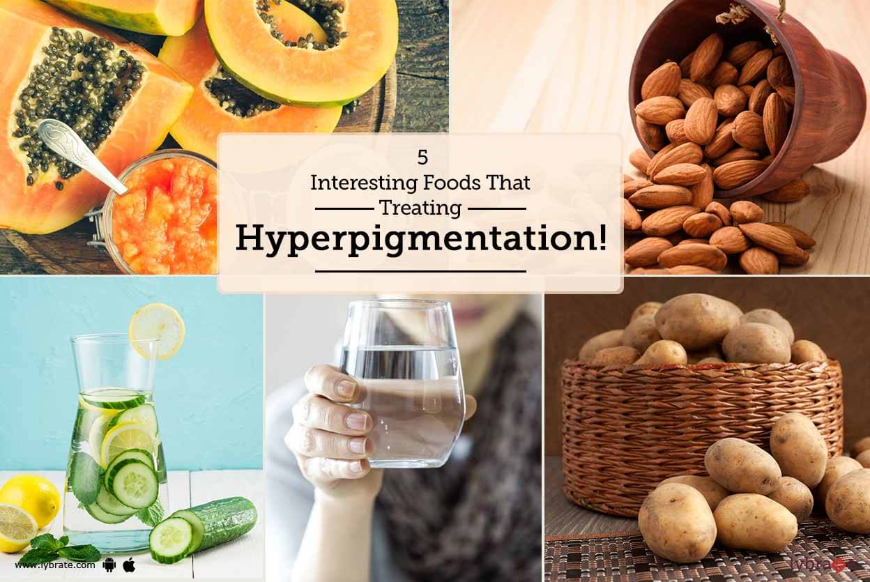 5 Interesting Foods That Treating Hyperpigmentation By Dr Rajesh Giridhar Chaudhari Lybrate Please check my disclosure policy to learn more. treating hyperpigmentation