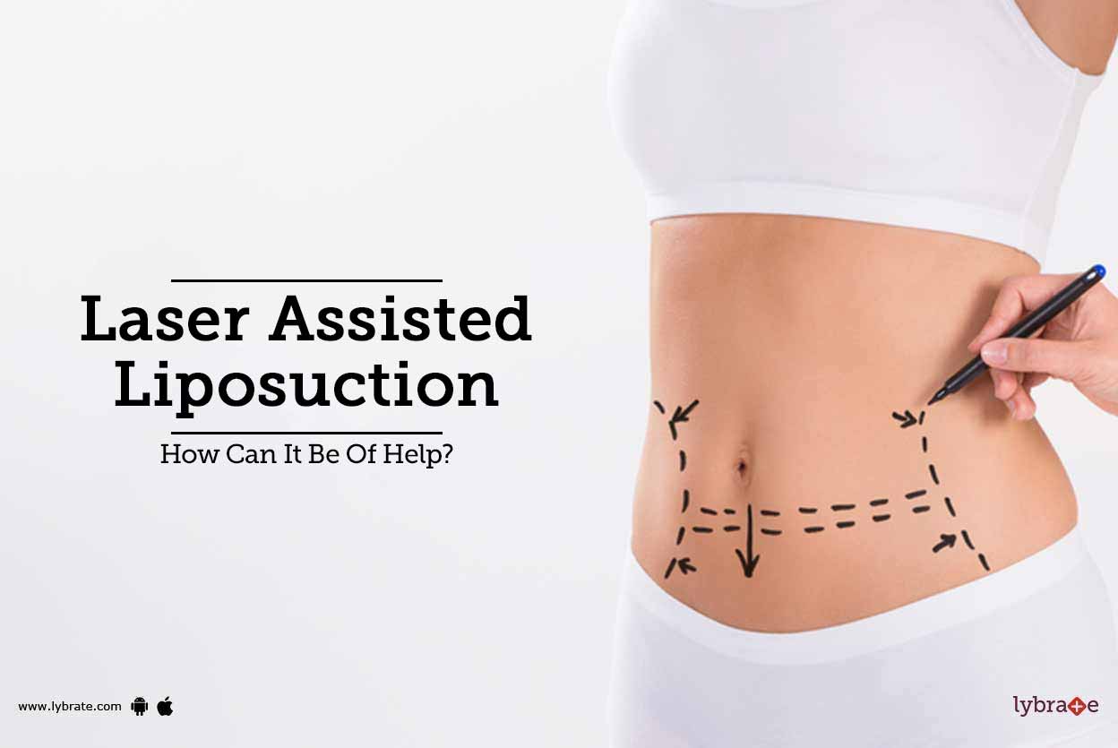 Laser Assisted Liposuction How Can It Be Of Help? By Dr. Amarendra