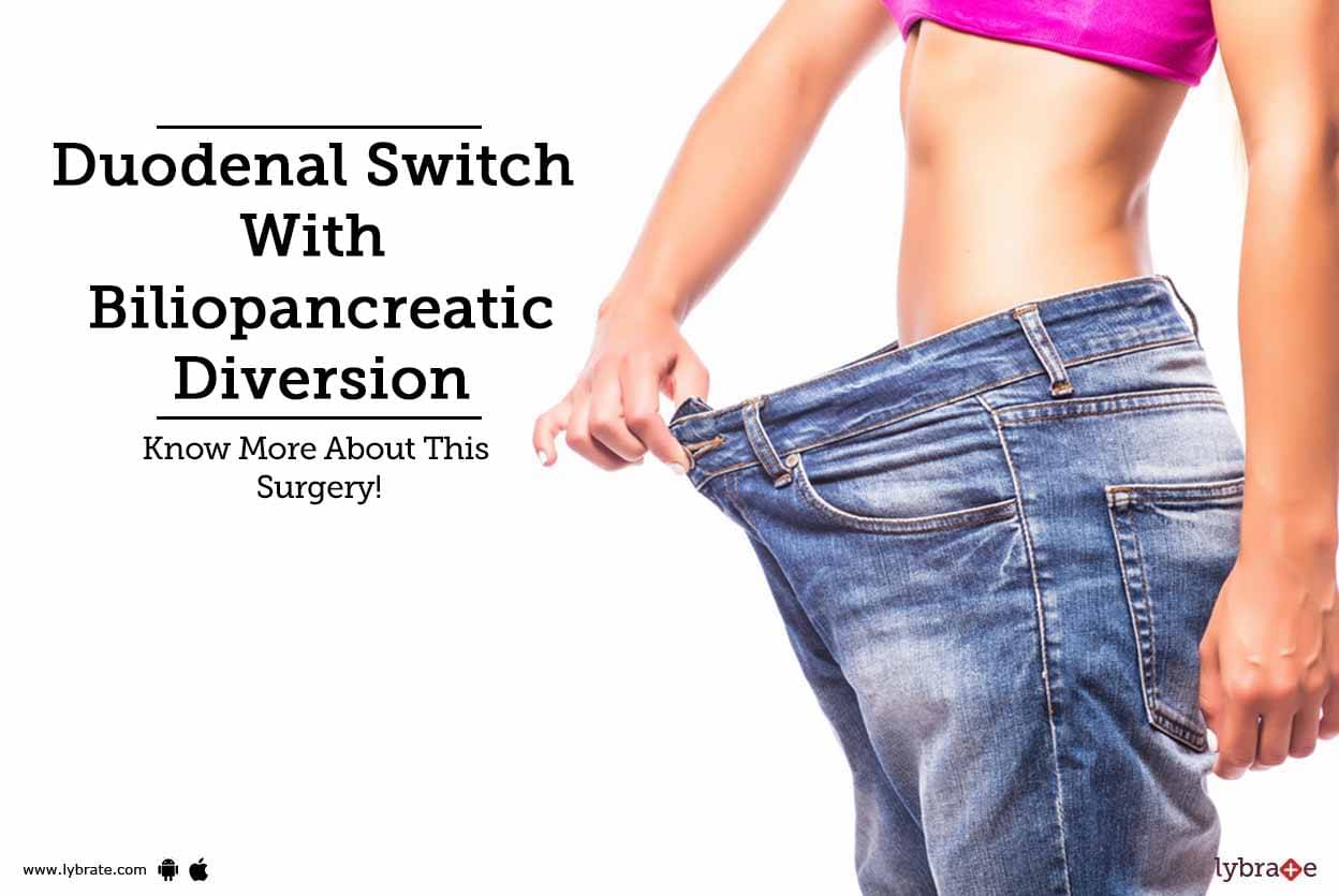 Duodenal Switch With Biliopancreatic Diversion - Know More About ...