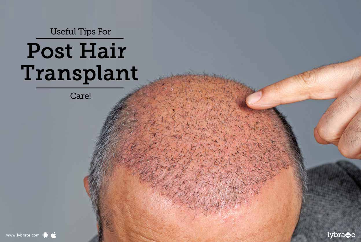 Useful Tips For Post Hair Transplant Care By Dr Sangeeta Varma