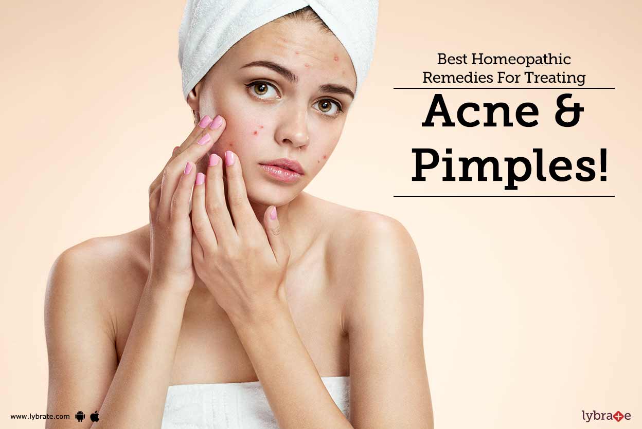 best homeopathic cream for pimples