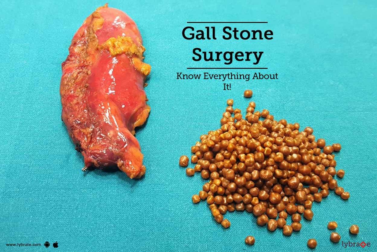 Gall Stone Surgery Know Everything About It! By Dr