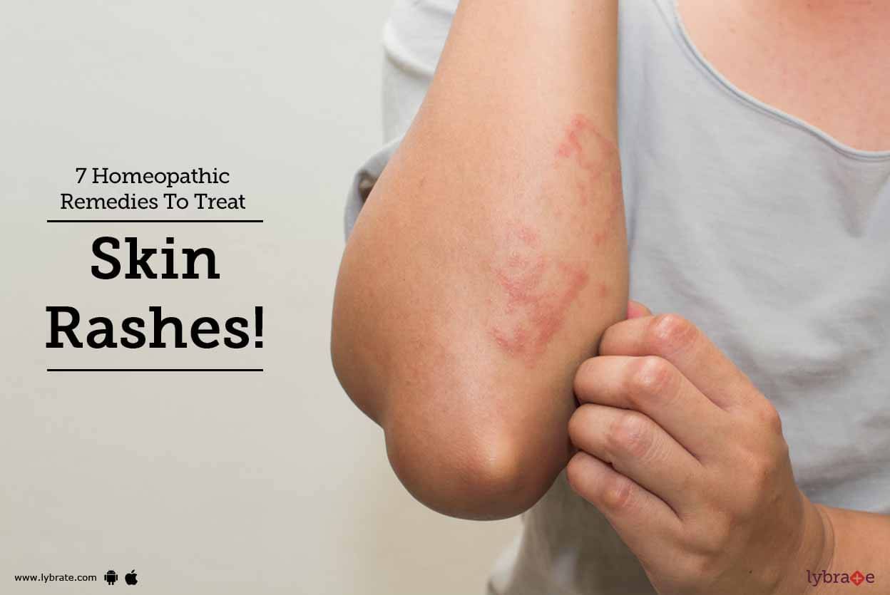 7 Homeopathic Remedies To Treat Skin Rashes By Dr Jagmati Singh 