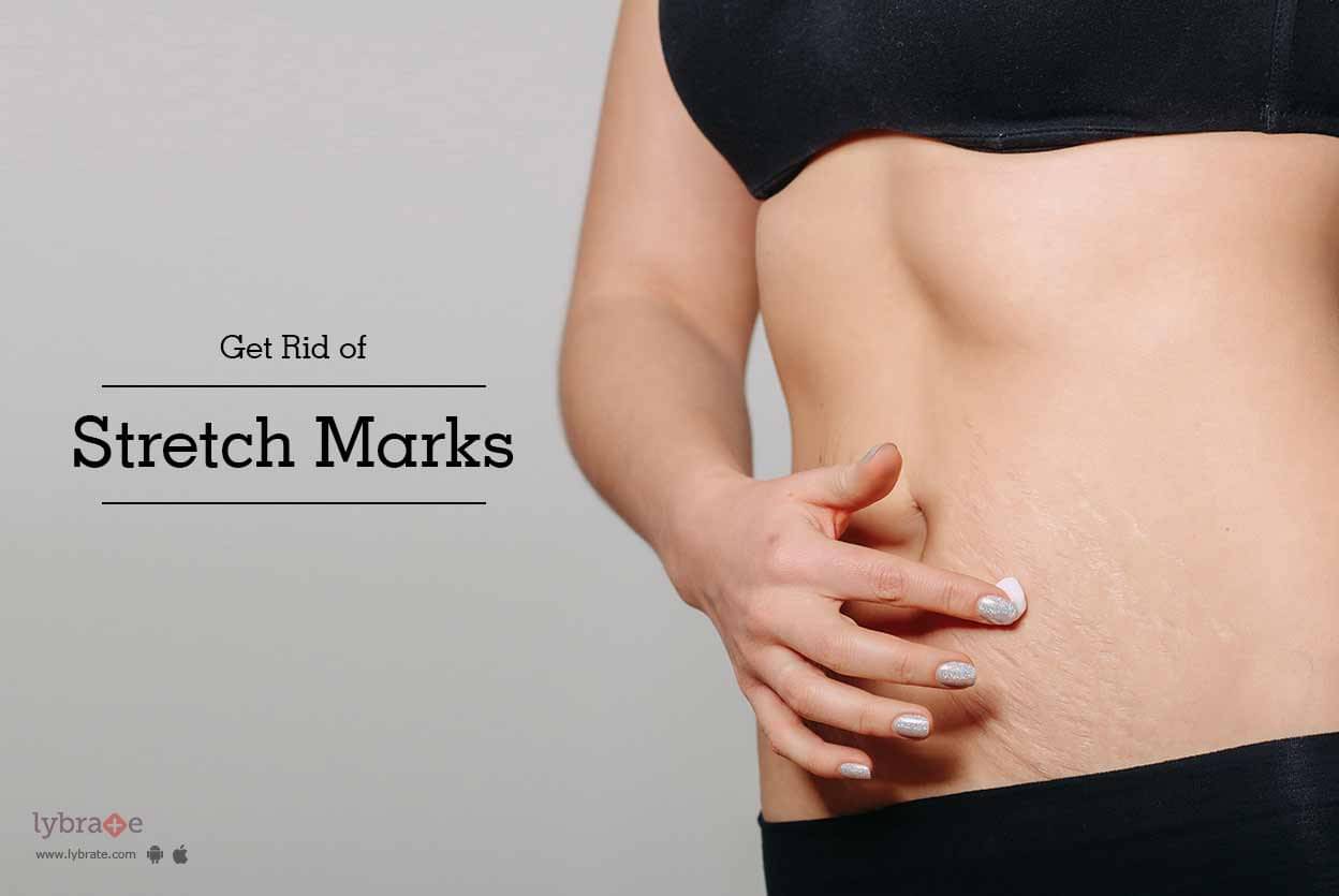 Home remedies to heal stretch marks - Femina.in