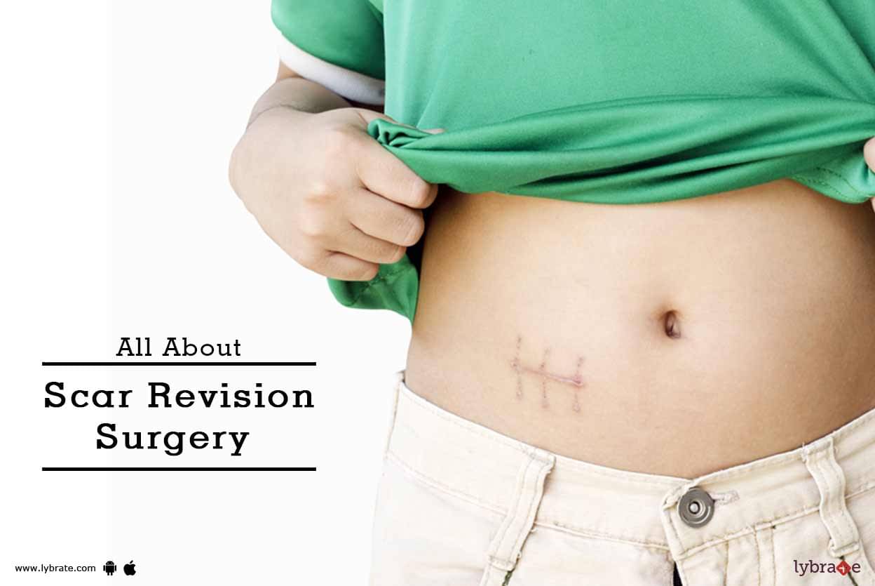 all-about-scar-revision-surgery-by-dr-bheem-s-nanda-lybrate