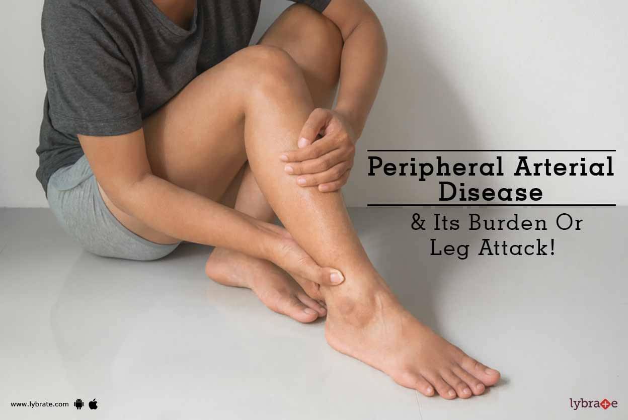 Peripheral Arterial Disease & Its Burden Or Leg Attack! - By Dr. Pravin