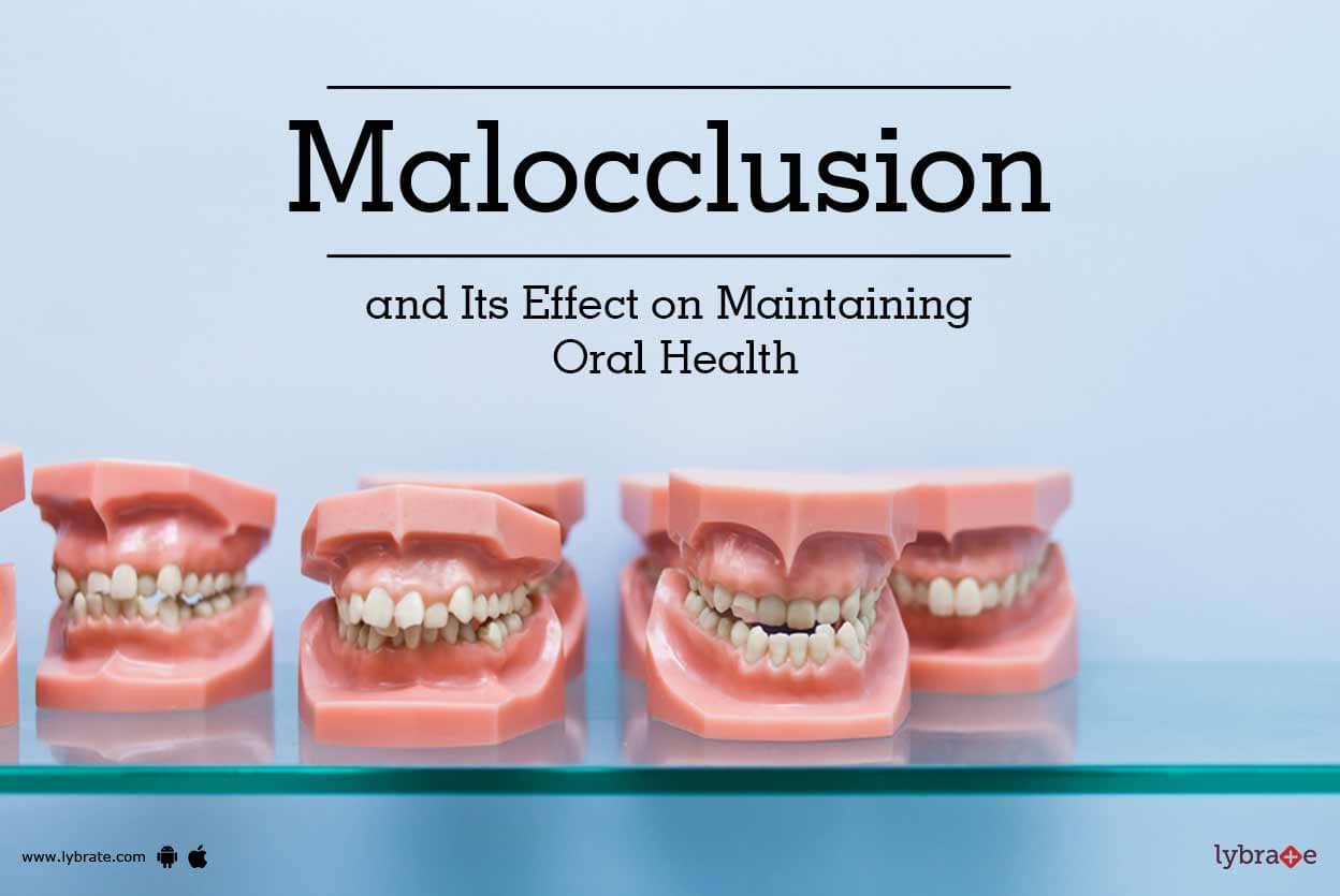 Malocclusion And Its Effect On Maintaining Oral Health By Dr Nishi