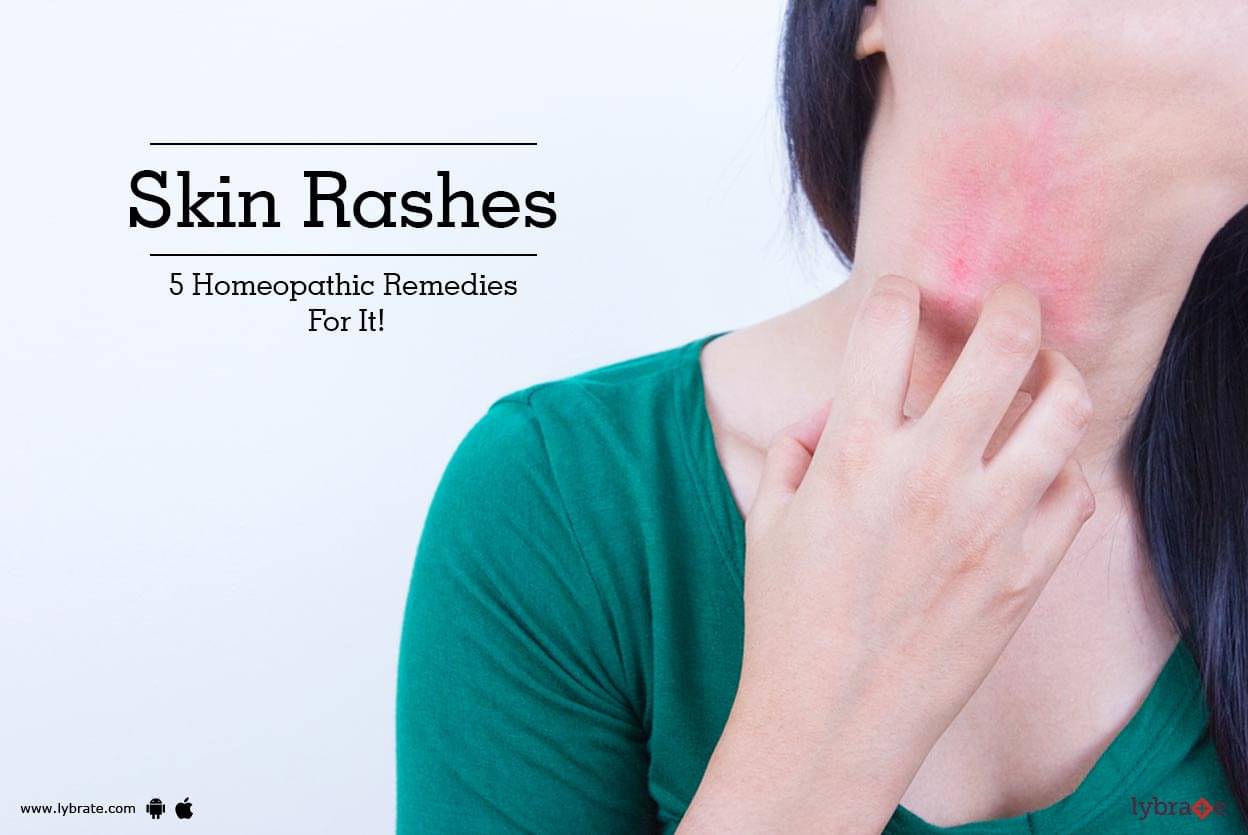 Skin Rashes 5 Homeopathic Remedies For It By Dr V K Pandey Lybrate