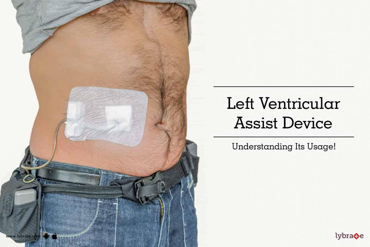 Ventricular Assist Device