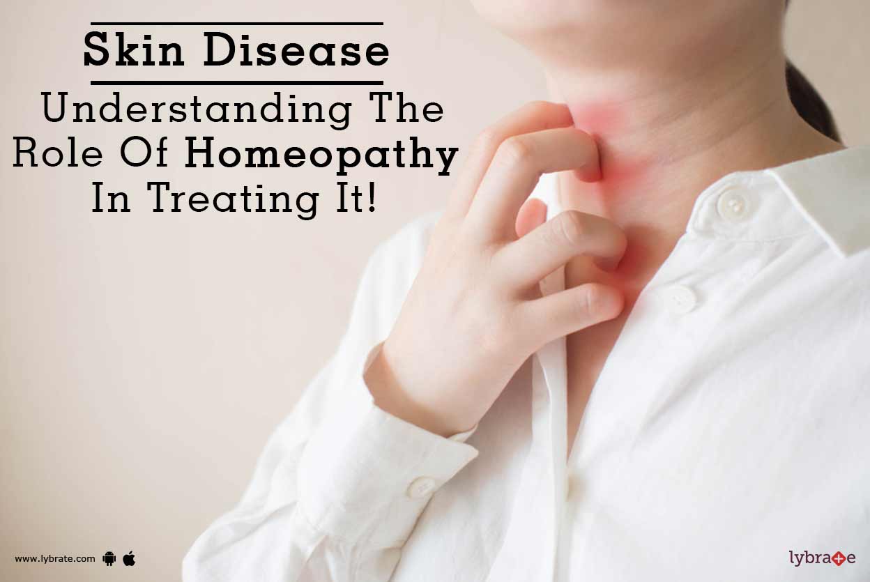 Skin Disease Understanding The Role Of Homeopathy In Treating It