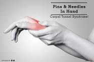 Pins Needles In Hand Carpal Tunnel Syndrome By Dr Sharad 