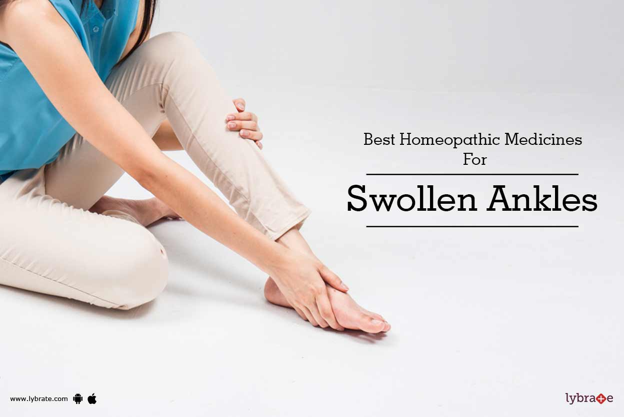 Best Homeopathic Medicines For Swollen Ankles By Dr. Jeevangouda