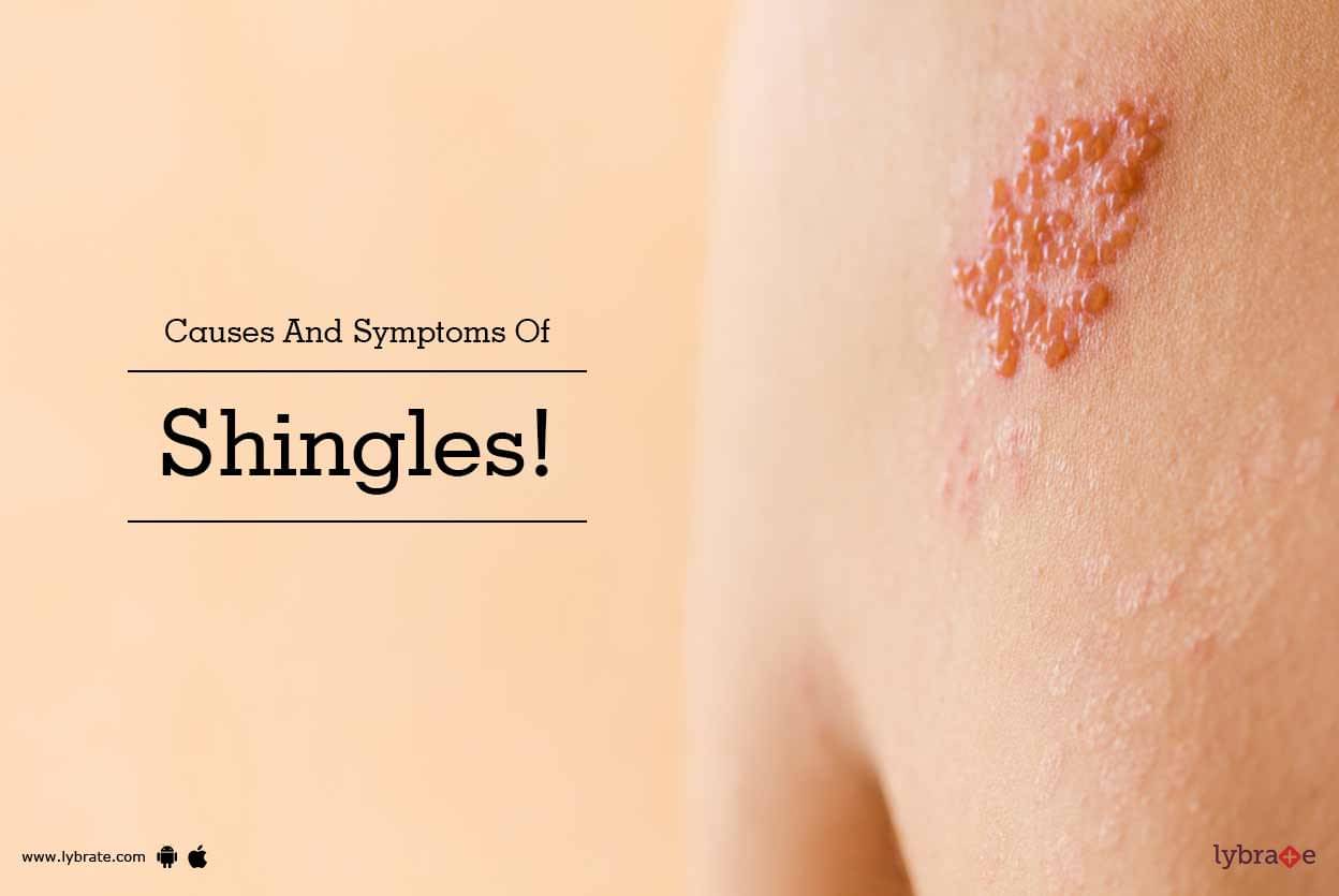 Causes And Symptoms Of Shingles By Dr Nitin Jain Lybrate 