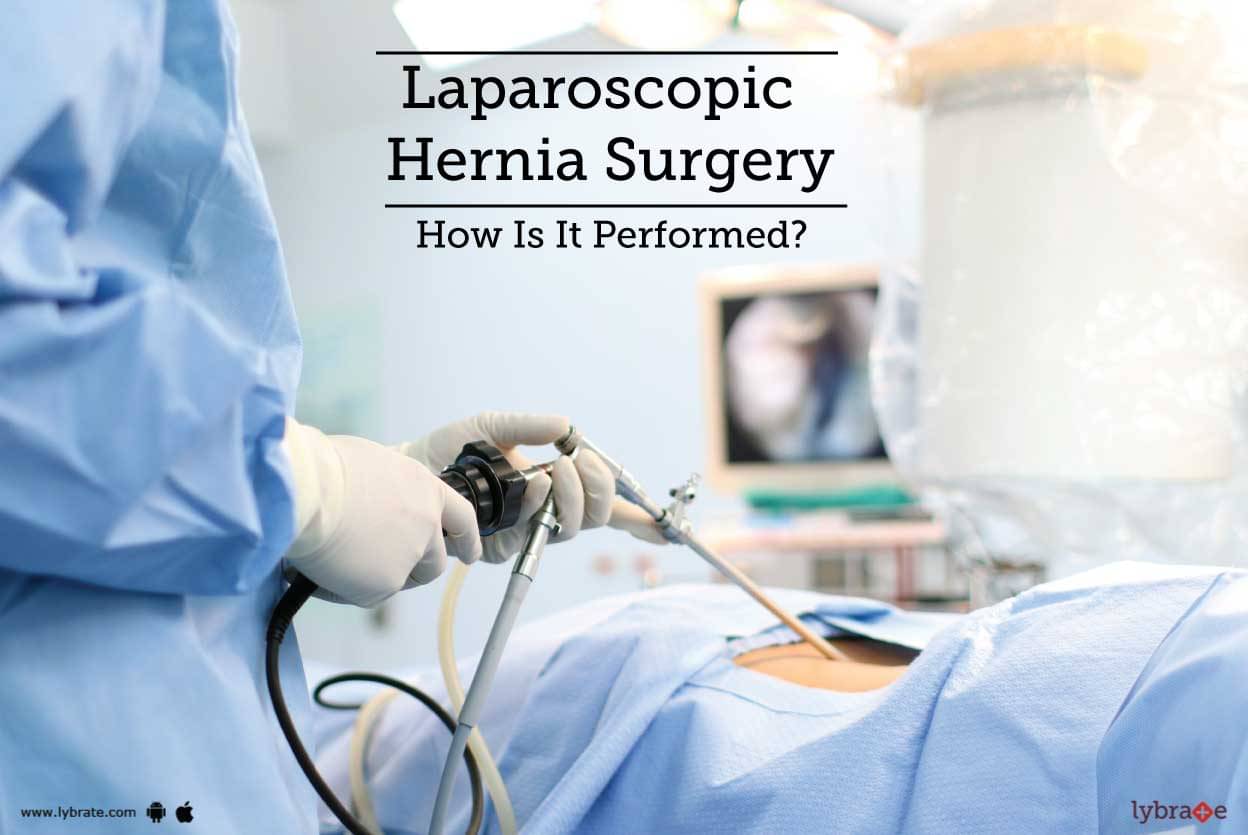 Laparoscopic Hernia Surgery - How Is It Performed? - By Dr. Manish ...