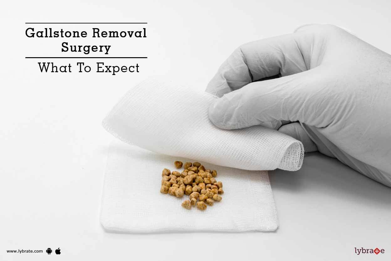 gallstone-removal-surgery-what-to-expect-by-dr-amit-jain-ms-mch