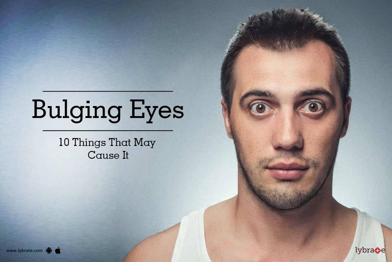 bulging eyes bulging eyes