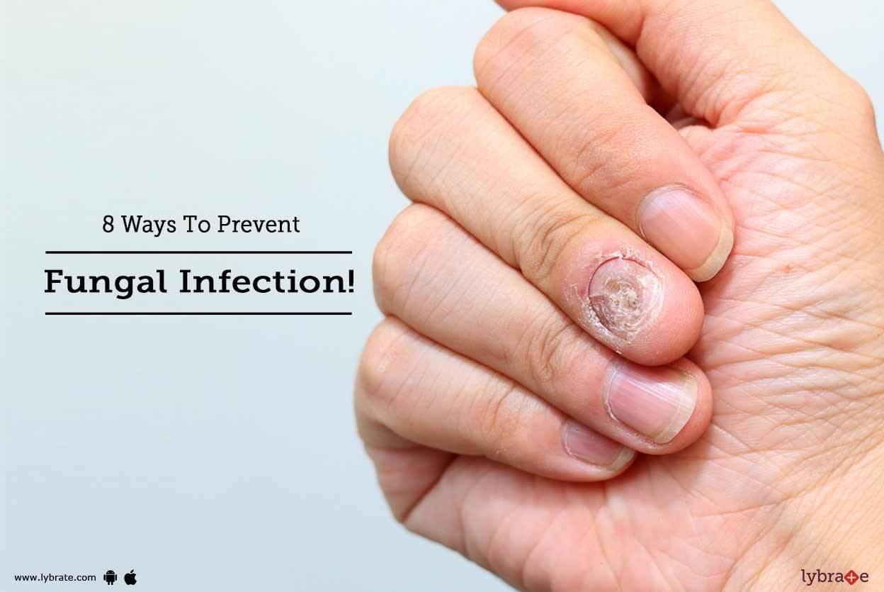 8 Ways To Prevent Fungal Infection! - By Dr. Vignessh Raj | Lybrate