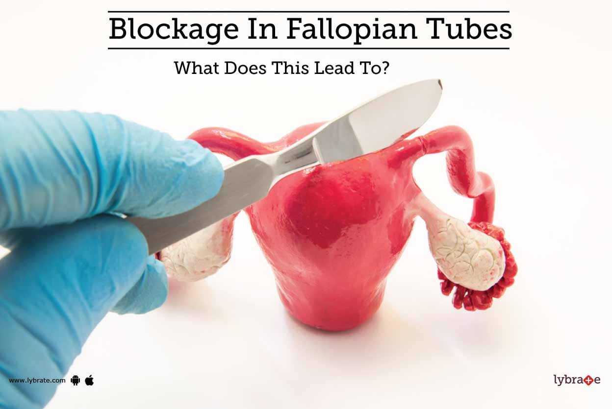 Blockage In Fallopian Tubes What Does This Lead To By Dr Prajakta