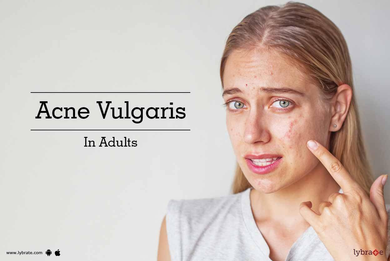 Acne Vulgaris In Adults By Dr Aanchal Sehrawat Lybrate