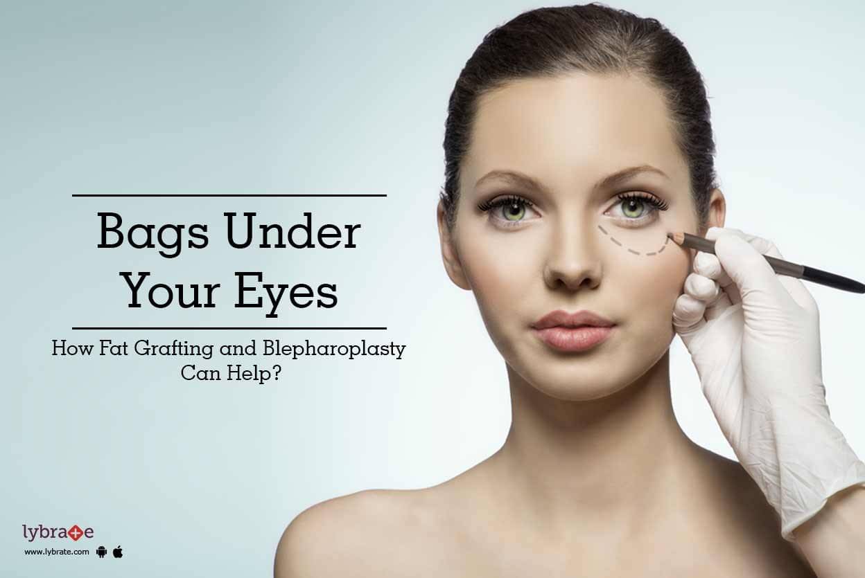 Bags Under Your Eyes - How Fat Grafting And Blepharoplasty Can Help 