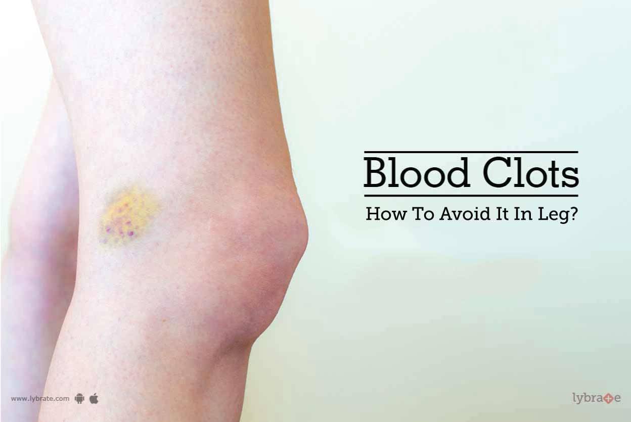 Blood Clots How To Avoid It In Leg? By Dr. Bappaditya Sarkar Lybrate