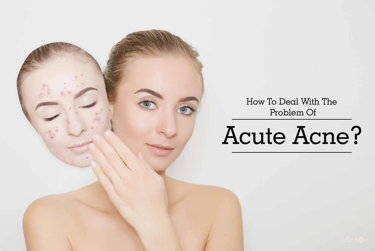 Vcare Face Treatment Cost - Doctor Heck