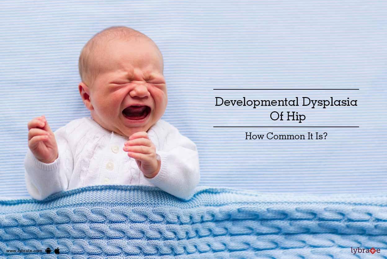 Hip Dysplasia Babies