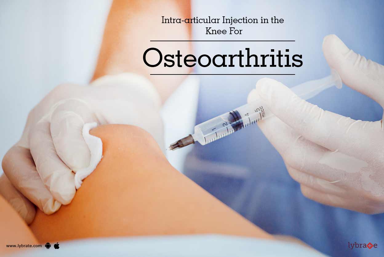 Intraarticular Injection in the Knee For Osteoarthritis By Dr. Biren Nadkarni Lybrate