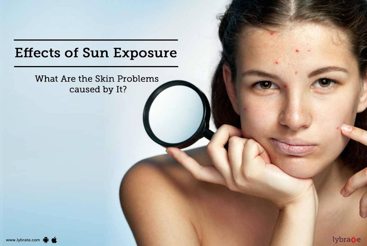 effects-of-sun-exposure-what-are-the-skin-problems-caused-by-it-by