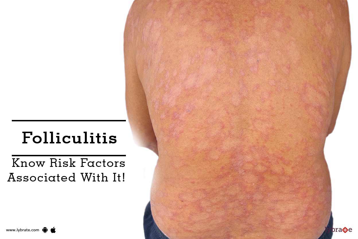 Folliculitis Know Risk Factors Associated With It! By Dr. Dinesh