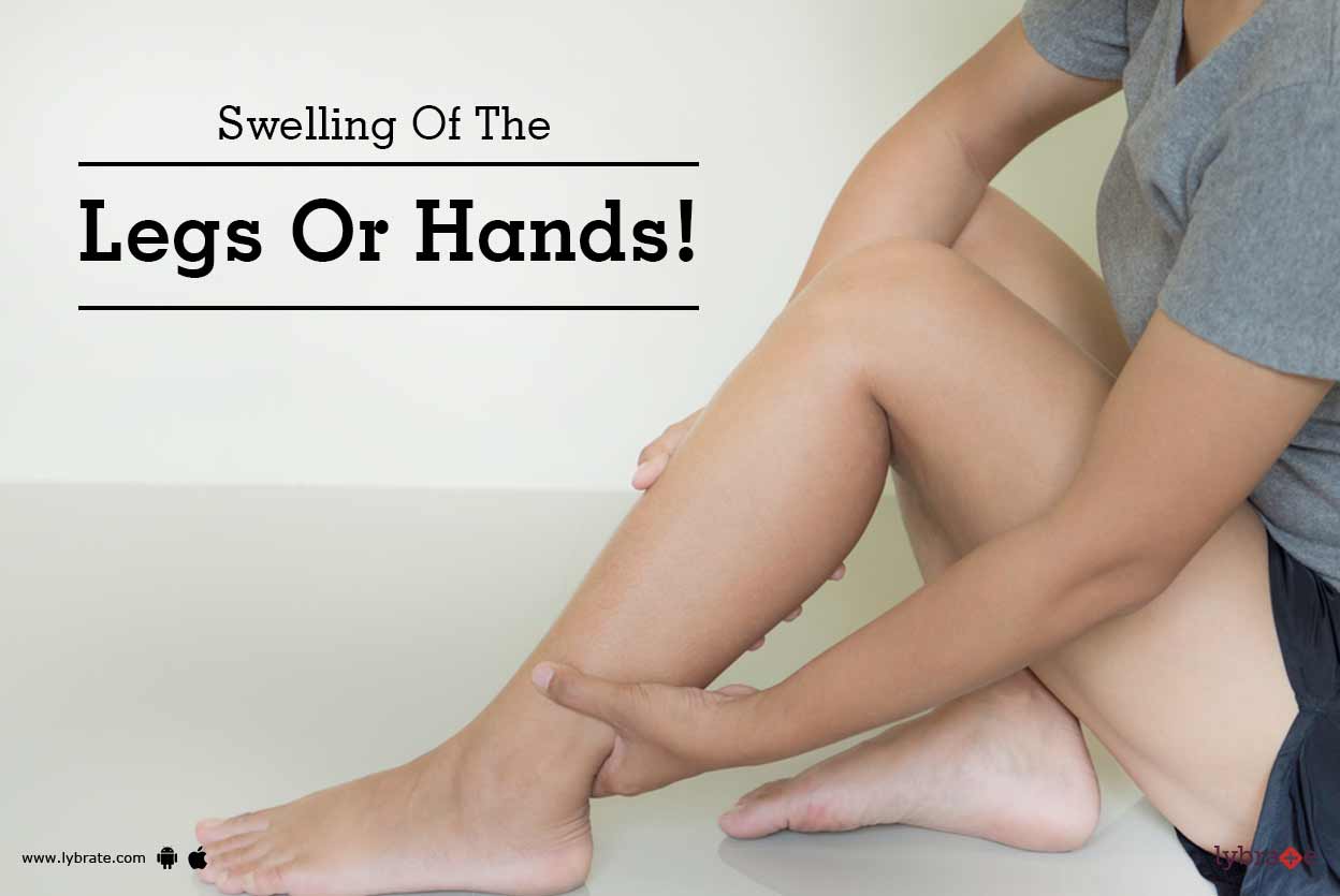 Swelling Of The Legs Or Hands By Dr Rahul N S Lybrate