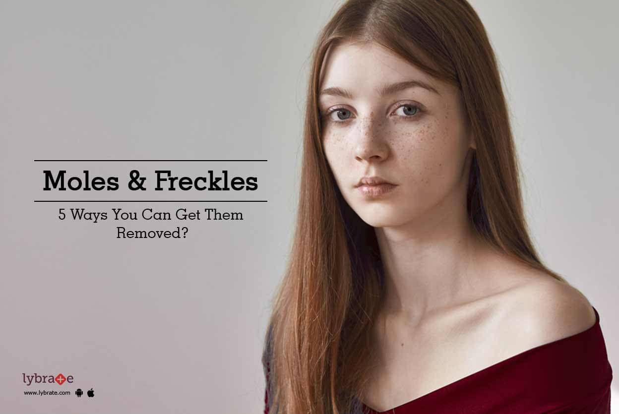 Naturally freckles to how remove and moles Top 10