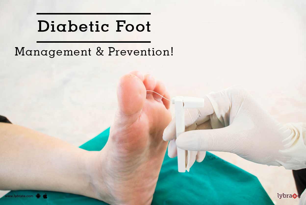 Diabetic Foot Management & Prevention! By Dr. Navneet Tripathi Lybrate