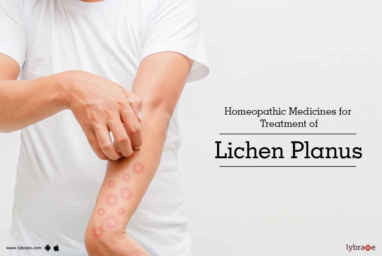 Homeopathic Medicines For Treatment Of Lichen Planus By Dr Prabha Acharya Lybrate