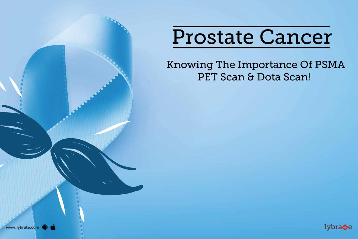 honvan para el cáncer de próstata