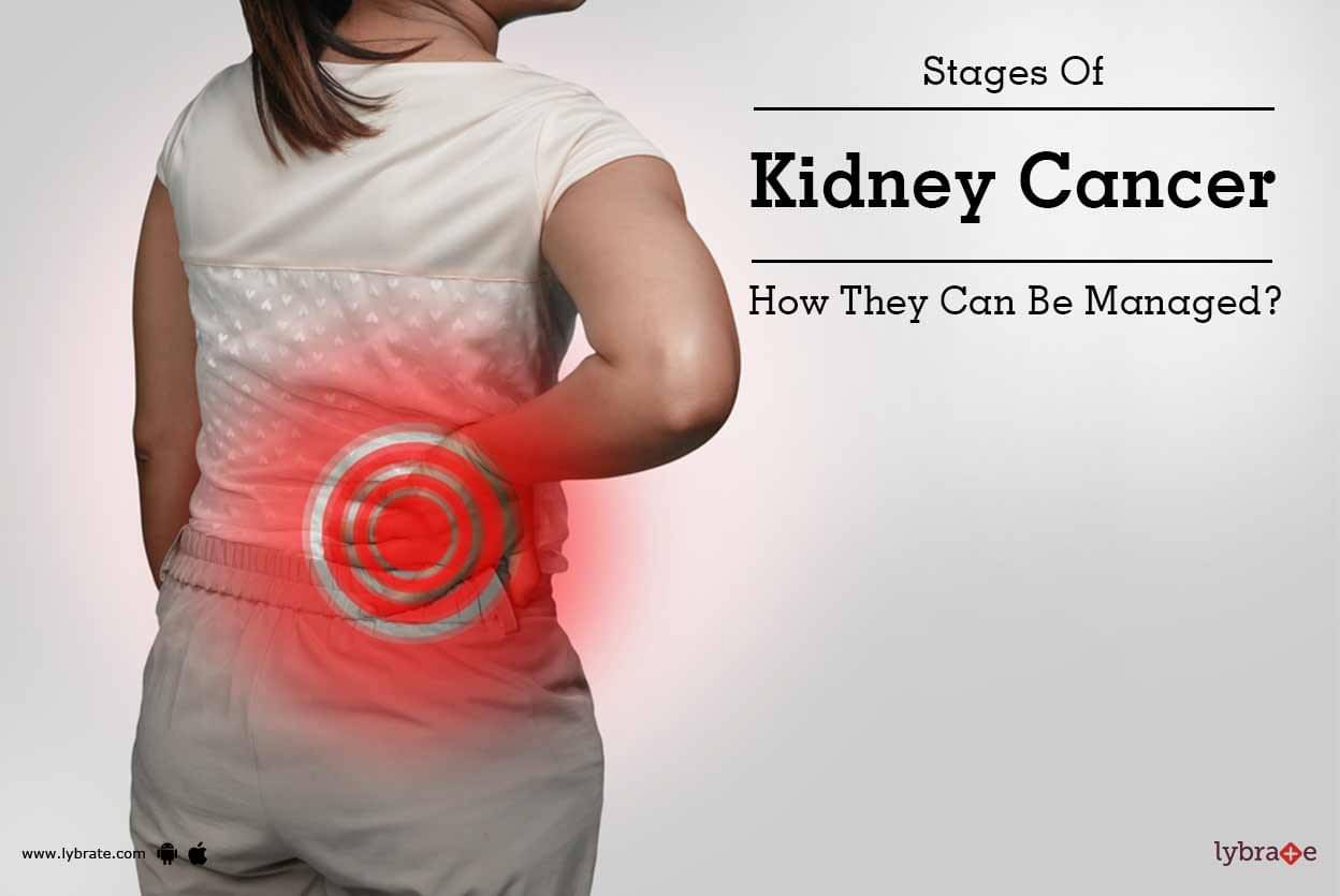 Stages Of Kidney Cancer How They Can Be Managed By Dr Mahendra