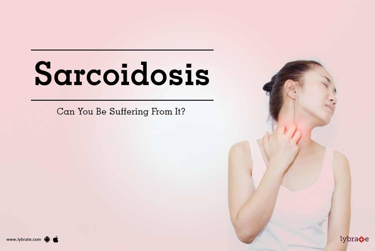 Sarcoidosis - Can You Be Suffering From It? - By Dr. Hemant Kalra | Lybrate