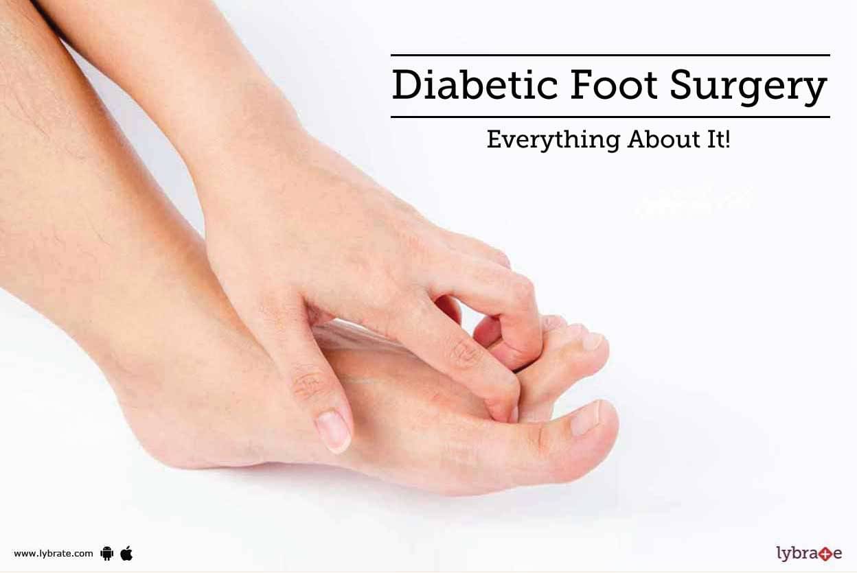Diabetic Foot Surgery - Everything About It! - By Dr. Shrikant Bhoyar ...