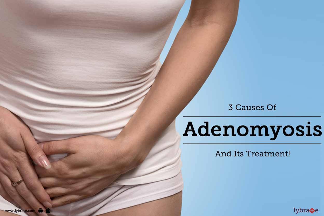 Adenomyosis Causes and Treatment