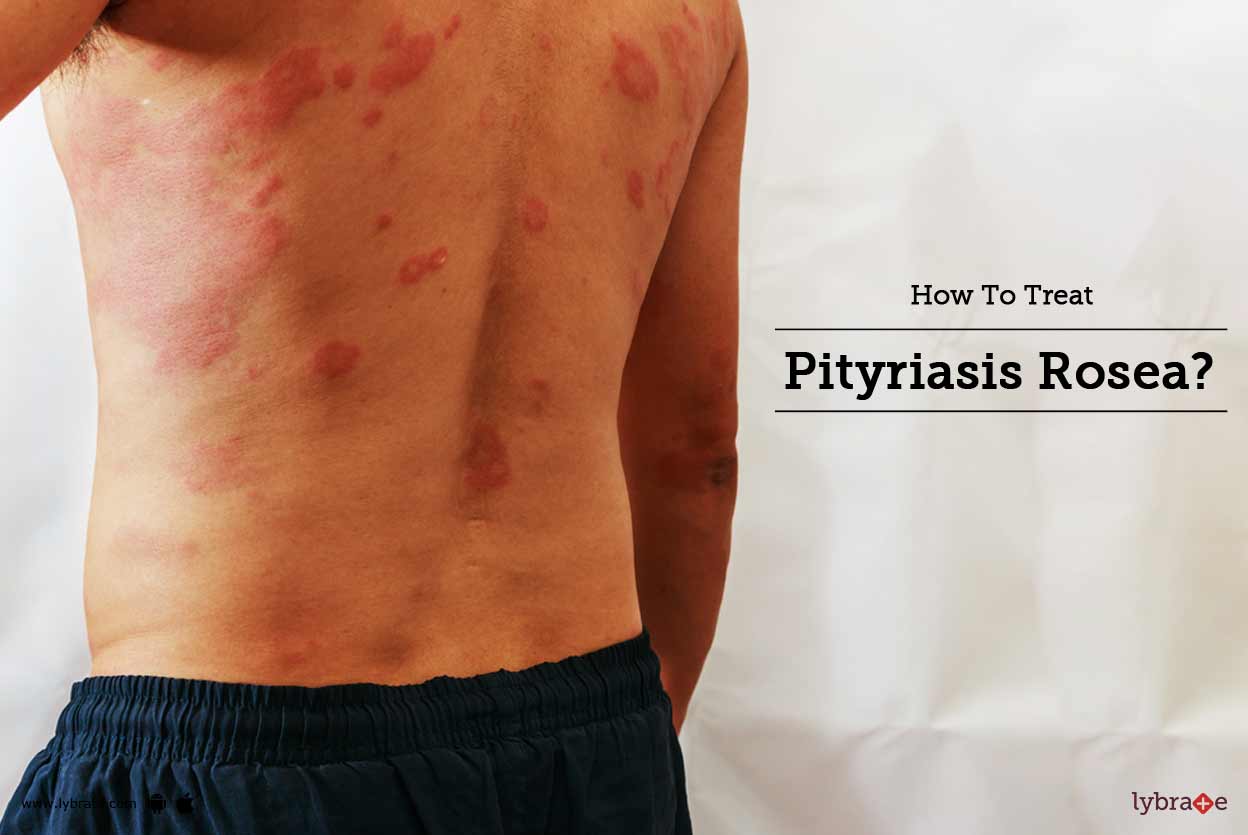 Pityriasis Rosea Diagnosis And Treatment MRFBK