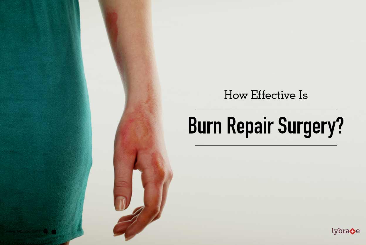 How Effective Is Burn Repair Surgery? By Dr. Harsh Bharat Amin Lybrate