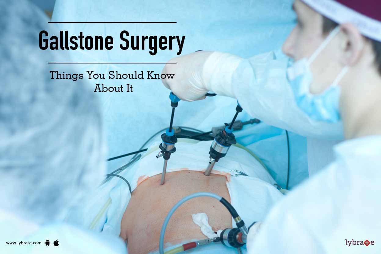 Gallstone Surgery - Things You Should Know About It - By 