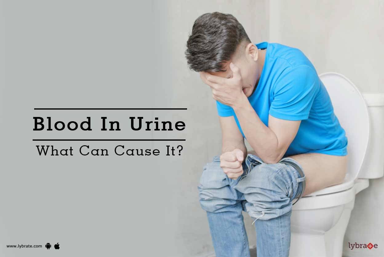 Blood In Urine What Can Cause It? By Dr. Sudin S R Lybrate